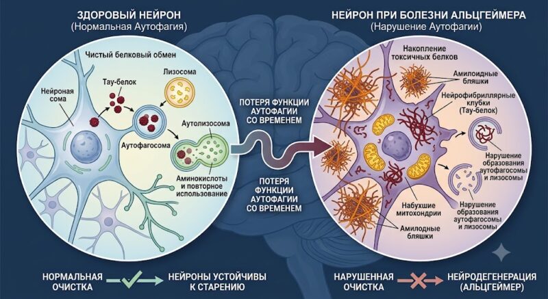 аутофагия и болезнь Альцгеймера
